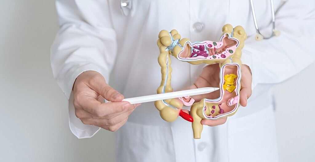 Types of Colorectal Cancer – Explained with Visual Model