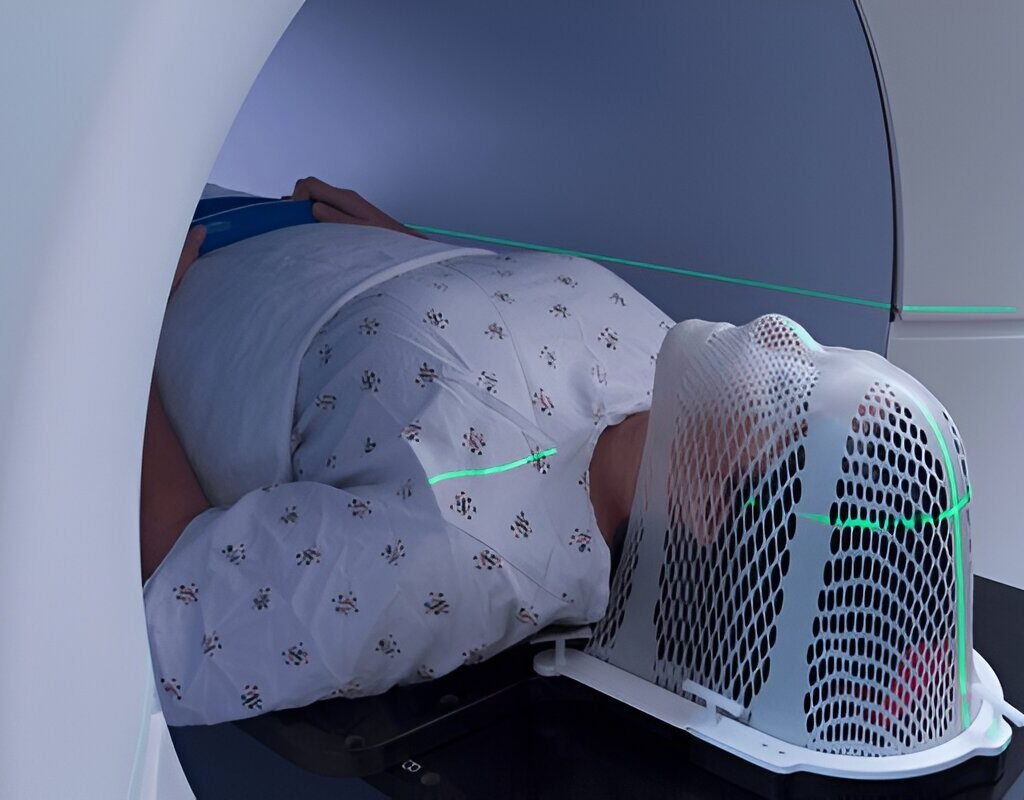 Radiation therapy setup I Under Phillip E Miles guidance
