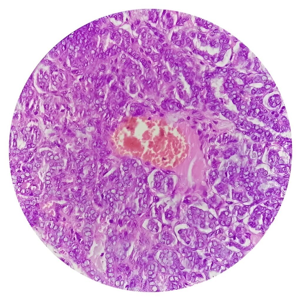Head and neck cancer microscopy